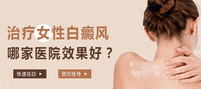 治疗女性白癜风哪家医院效果好?(图1)