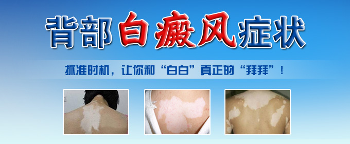 背部患上白癜风会有哪些症状呢?(图1)