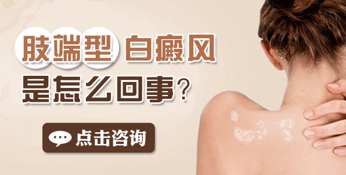 肢端型白癜风是怎么回事?(图1)