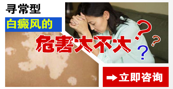 寻常型白癜风的危害大不大？(图1)
