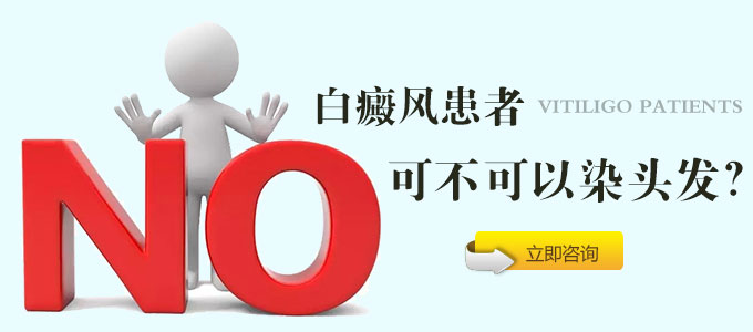 白癜风患者可不可以染头发?(图1)