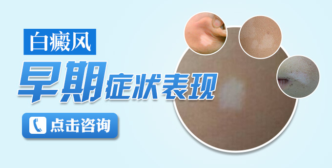 白癜风早期症状表现有哪些(图1)