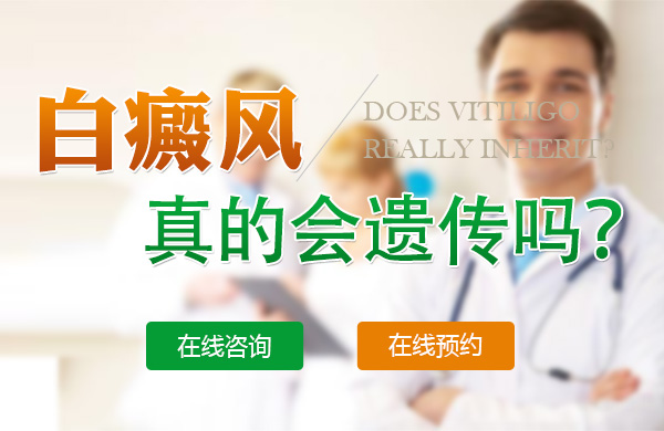白癜风究竟遗传吗