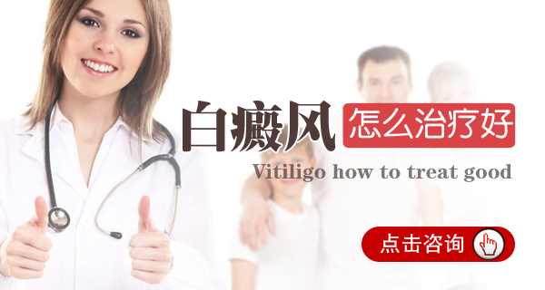 白癜风应该怎么治疗好