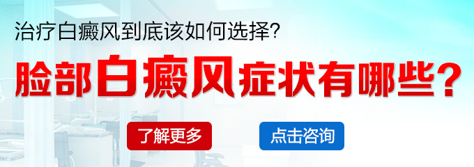 脸部白癜风症状有哪些？(图1)