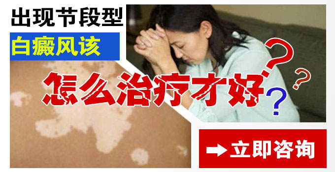 出现节段型白癜风应该怎么治疗才好?(图1)